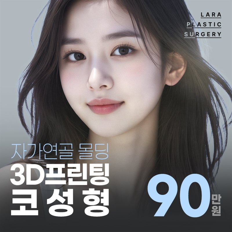 라라성형외과 이벤트 배너 — 자가연골 몰딩 3D프린팅 코성형 90만원