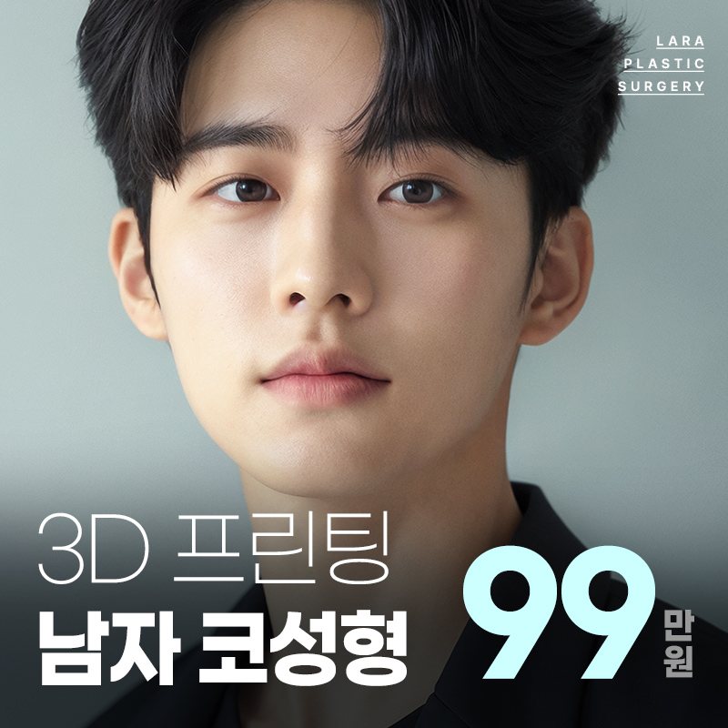 라라성형외과 이벤트 배너 — 3D 프린팅 남자 코성형 99만원
