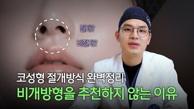 유튜브 썸네일 — 흉터 없는 비개방형, 정밀한 개방형 👃 어떤 기준으로 선택해야 할까요? | 라라성형외과