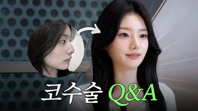 유튜브 썸네일 — 무보형물 코수술 한달차 후기 Q&A 💬 | 수술전 인터뷰, 코성형 통증 및 붓기, 부모님 현실반응, 수술 중 마취풀린 썰 | 라라성형외과