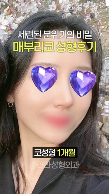 라라성형외과 쇼츠 썸네일 — 매부리코 성형후기