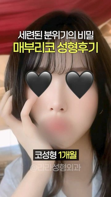 라라성형외과 쇼츠 썸네일 — 매부리코 성형후기