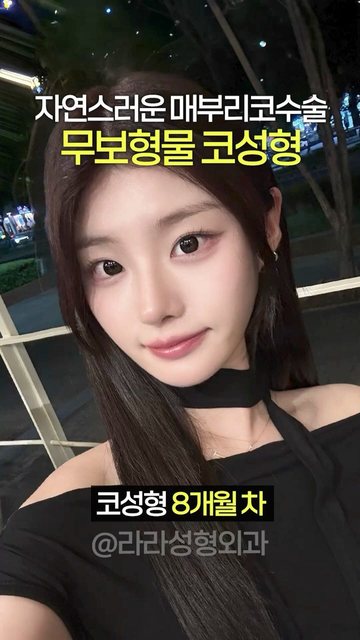 라라성형외과 쇼츠 썸네일 — 코 비대칭 자연스럽게 교정하는 #무보형물코성형