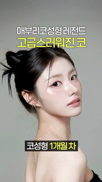 라라성형외과 쇼츠 썸네일 — 고급스러운 코성형 후기 #무보형물코성형