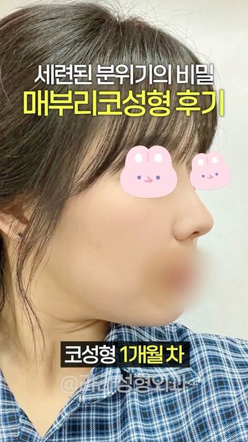 라라성형외과 쇼츠 썸네일 — 세련된 한끝차이 #매부리코성형