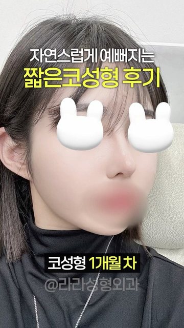 라라성형외과 쇼츠 썸네일 — 자연스럽게 예뻐지는 짧은코성형 후기