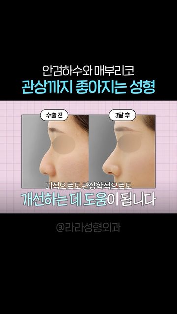 유튜브 쇼츠 썸네일 — 성형했는데 관상까지 좋아졌다?