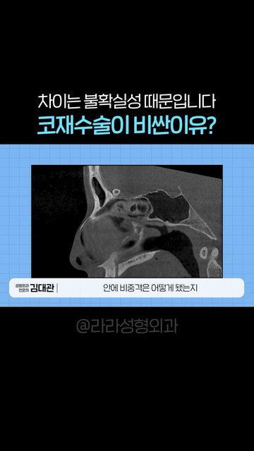 유튜브 쇼츠 썸네일 — 코재수술이 비싼 이유