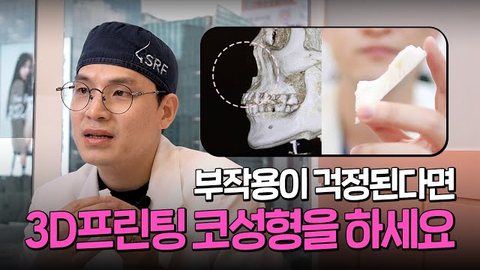 부작용이 걱정된다면 3D프린팅 코성형을 하세요 3D프린팅 코성형 총정리